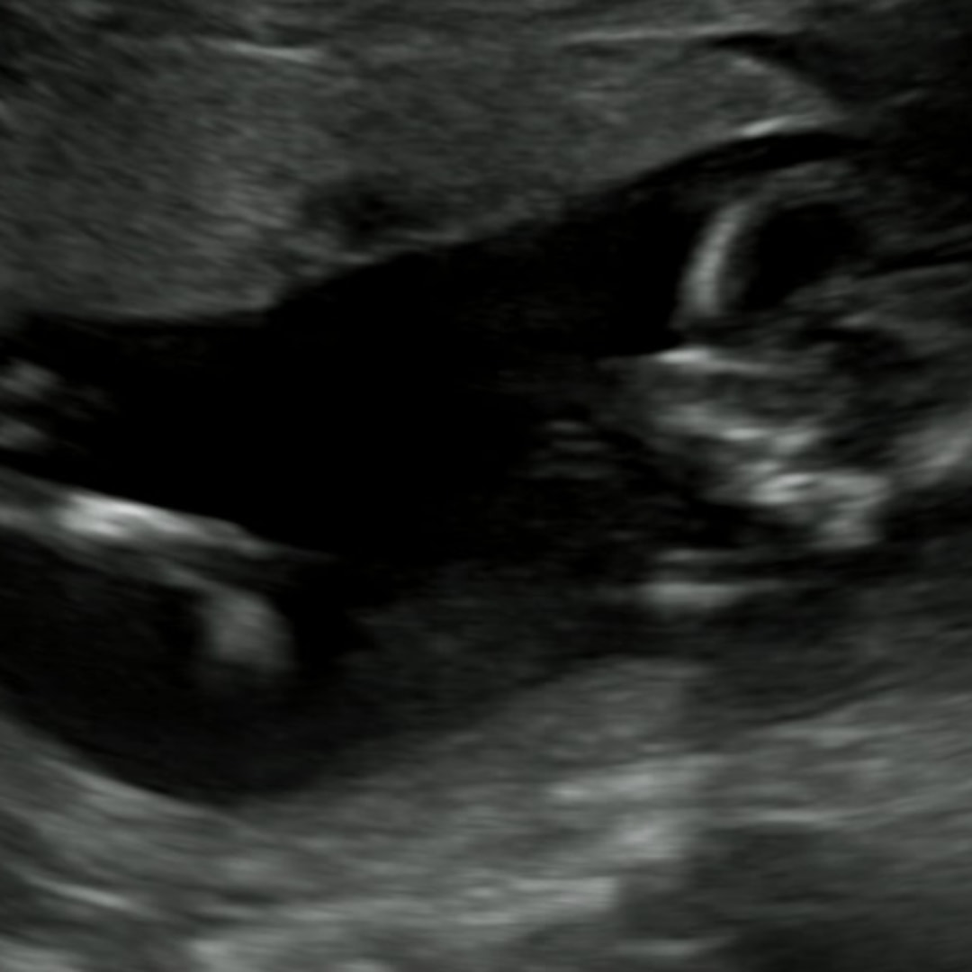 Photo shared by Desiree for their Babylist baby registry.