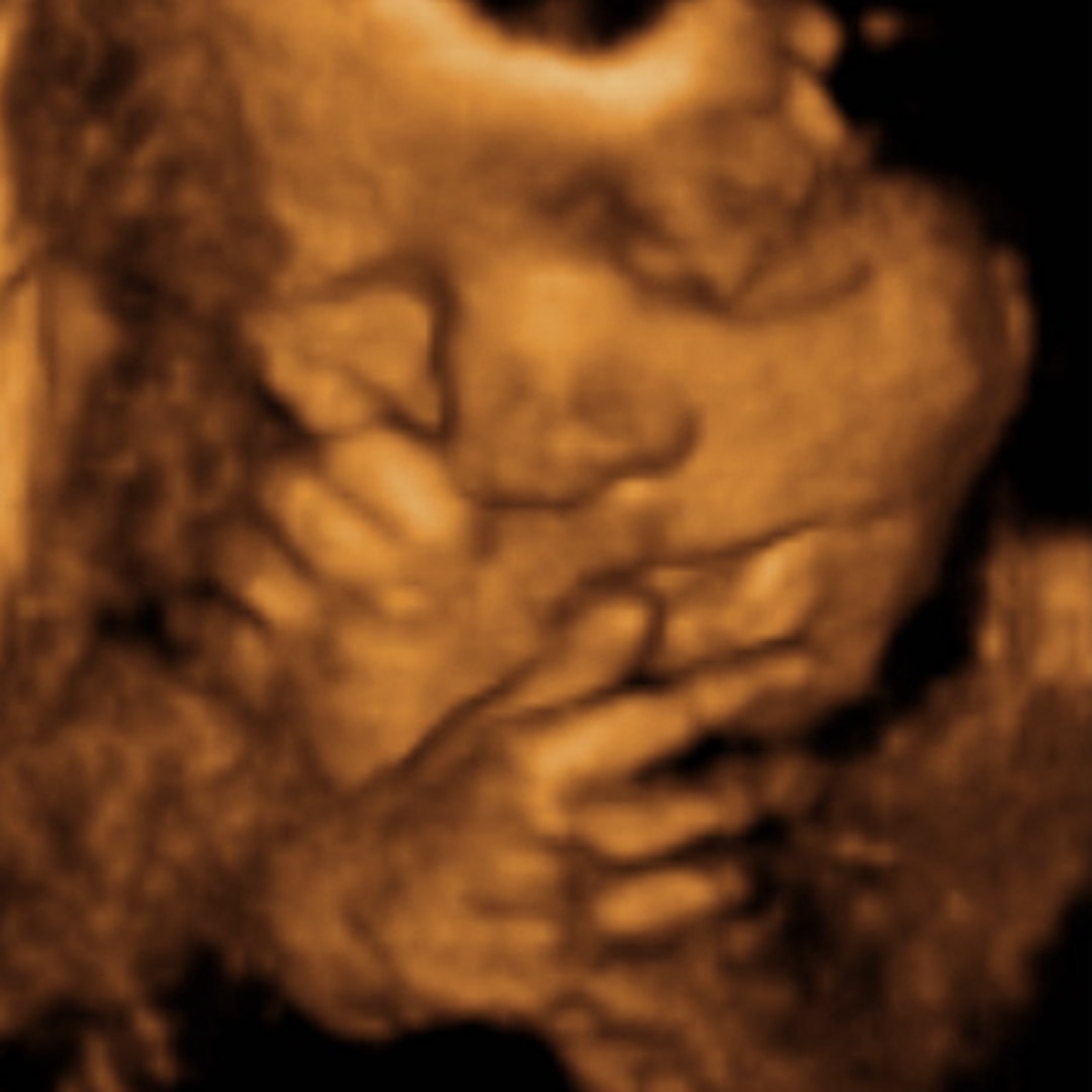 Photo shared by Briseis for their Babylist baby registry.