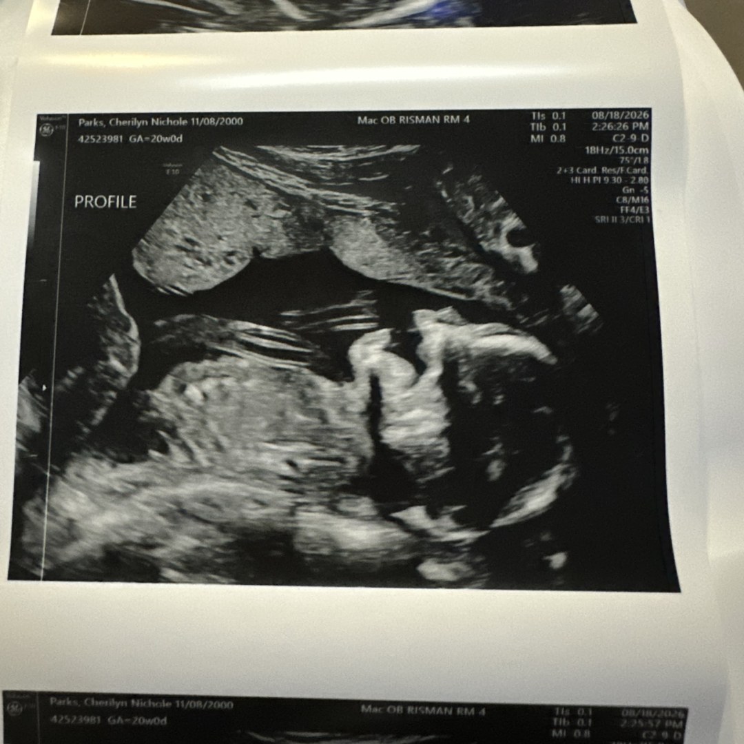 Photo shared by Cher for their Babylist baby registry.