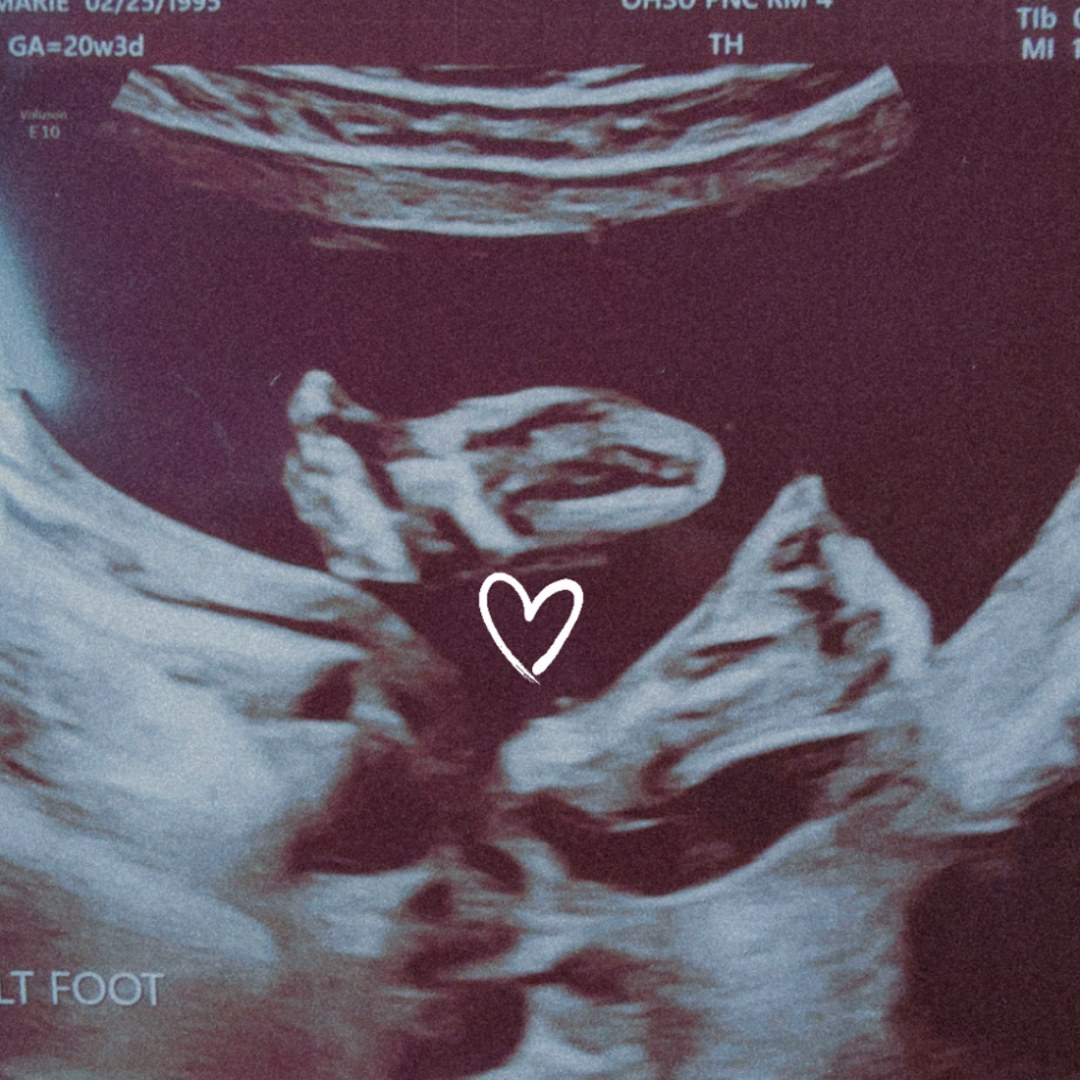 Photo shared by Kimarie for their Babylist baby registry.