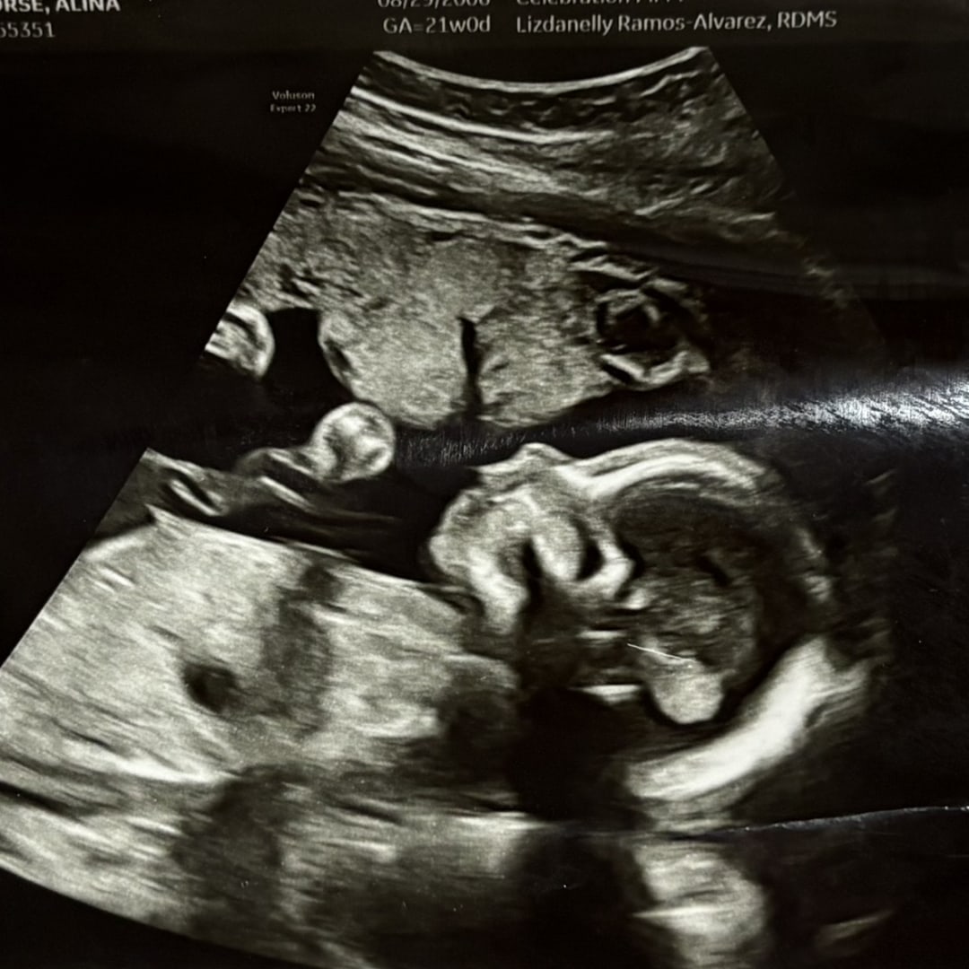 Photo shared by Alina for their Babylist baby registry.