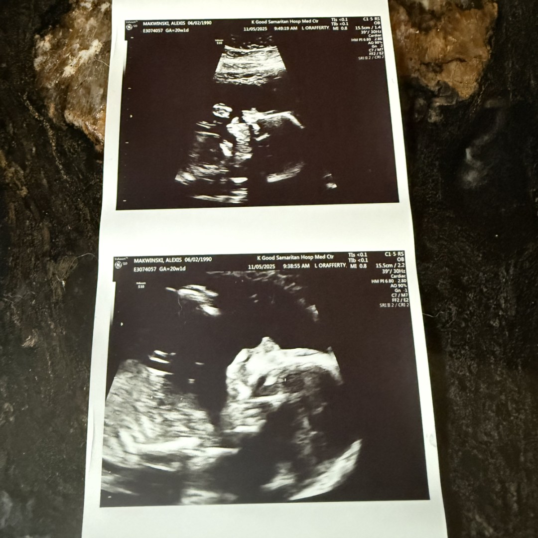 Photo shared by Alexis for their Babylist baby registry.