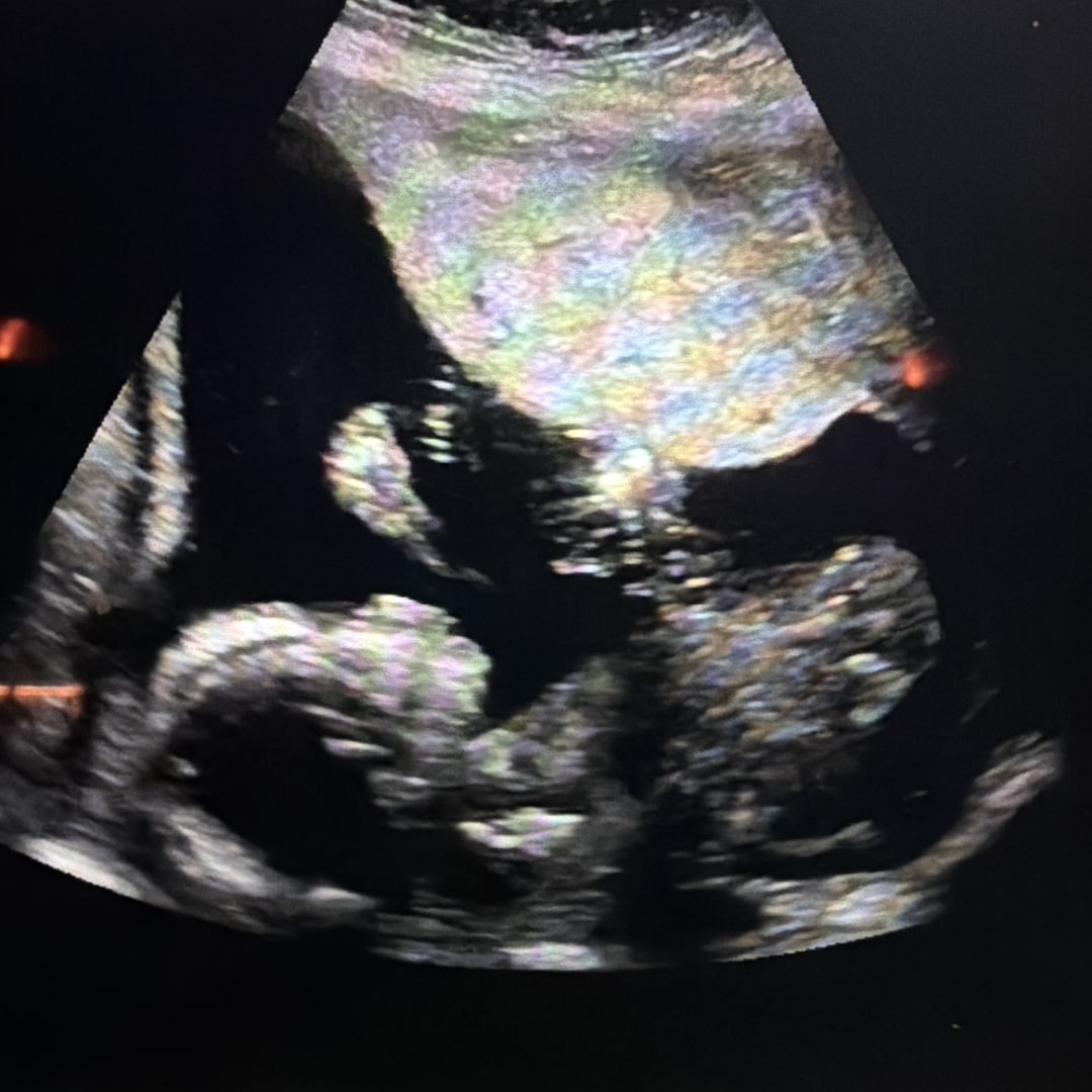 Photo shared by Lacy for their Babylist baby registry.