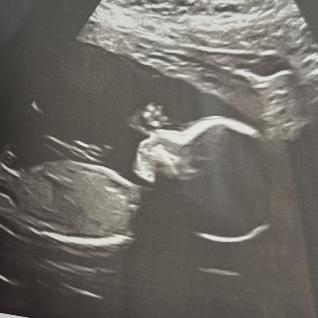 Photo shared by Katelynn for their Babylist baby registry.