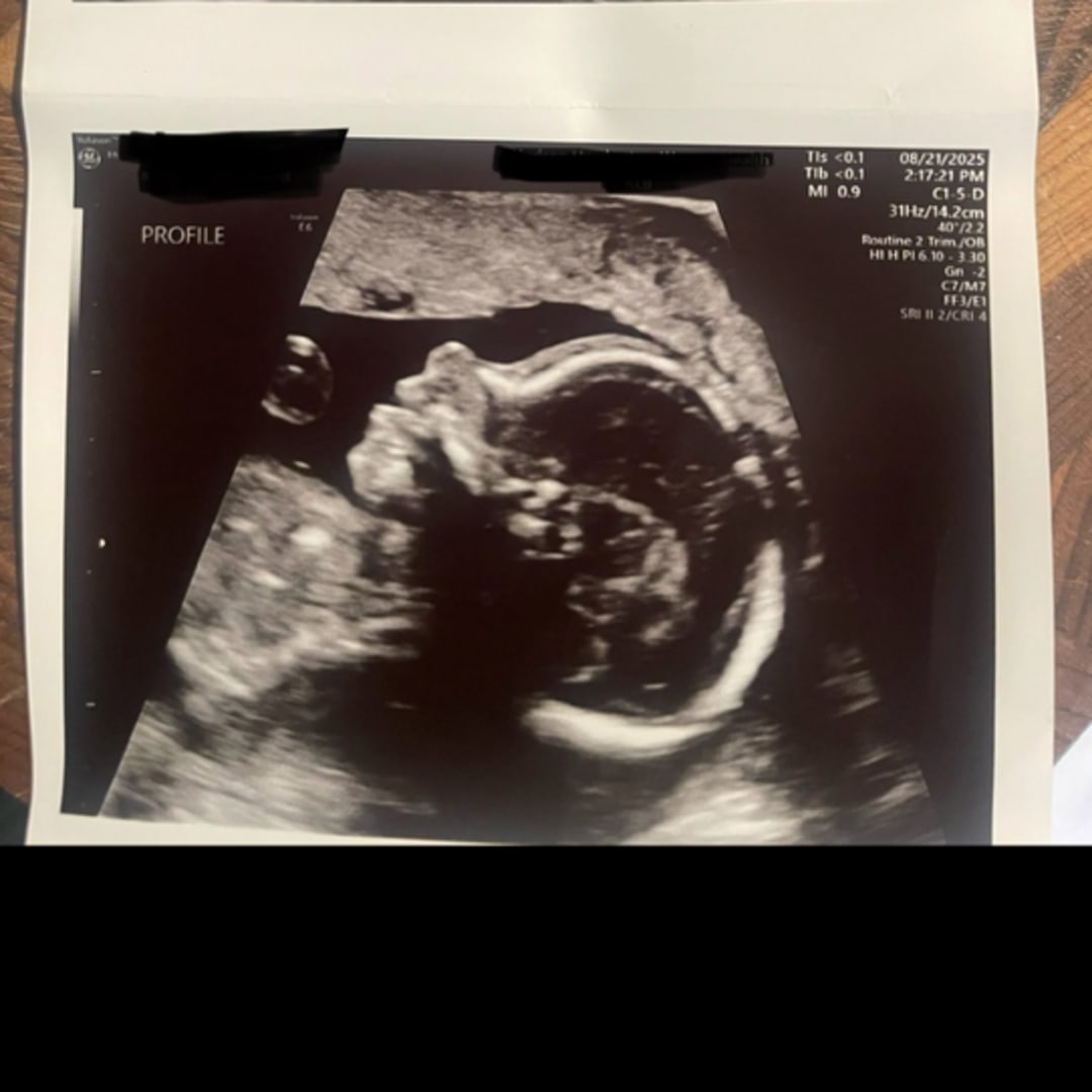 Photo shared by Abby for their Babylist baby registry.