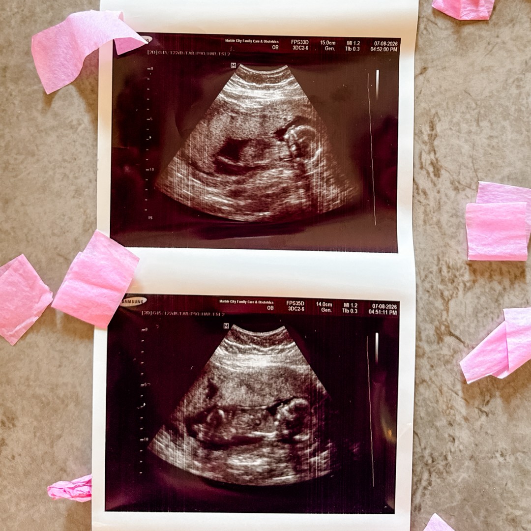 Photo shared by Taylor for their Babylist baby registry.