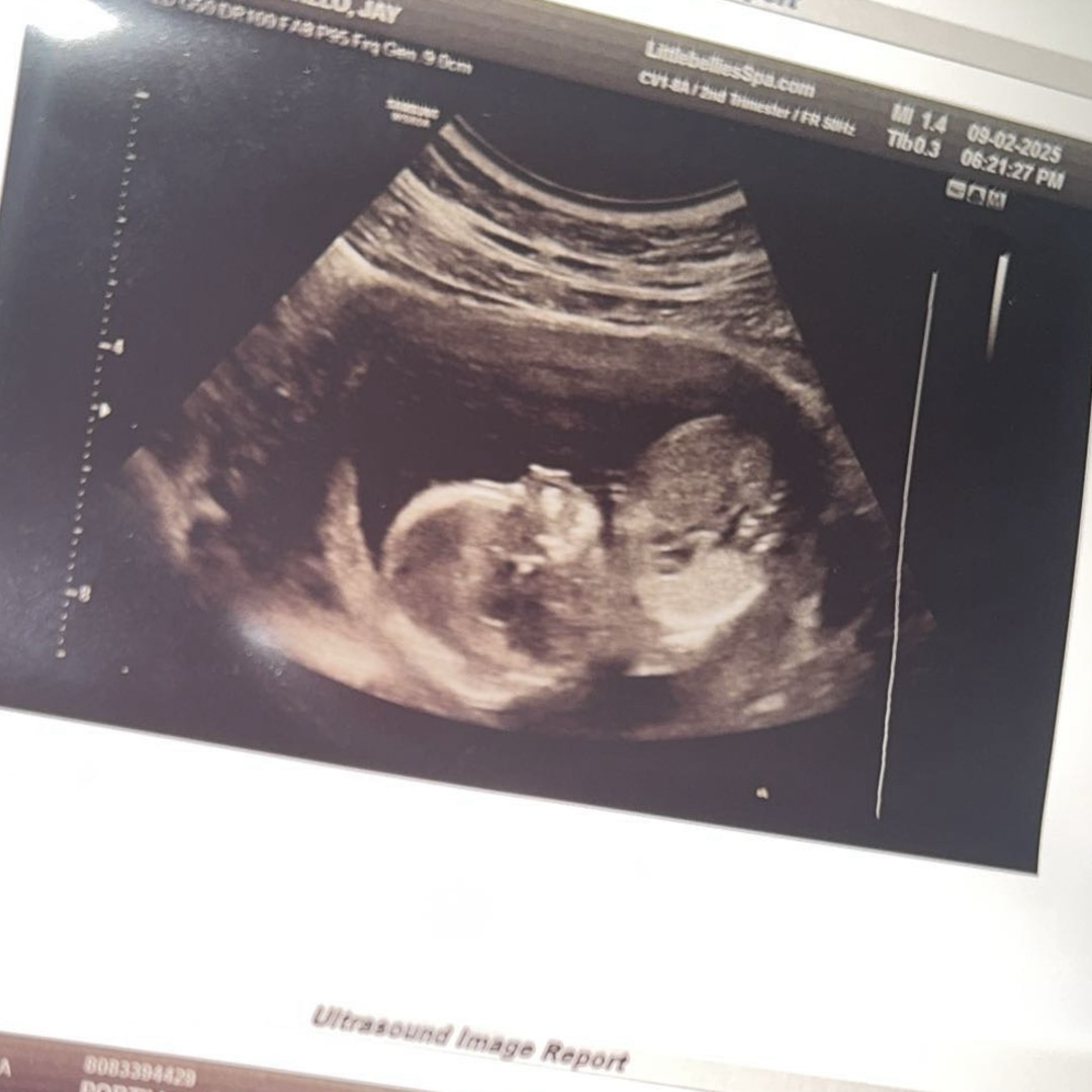 Photo shared by Jay for their Babylist baby registry.