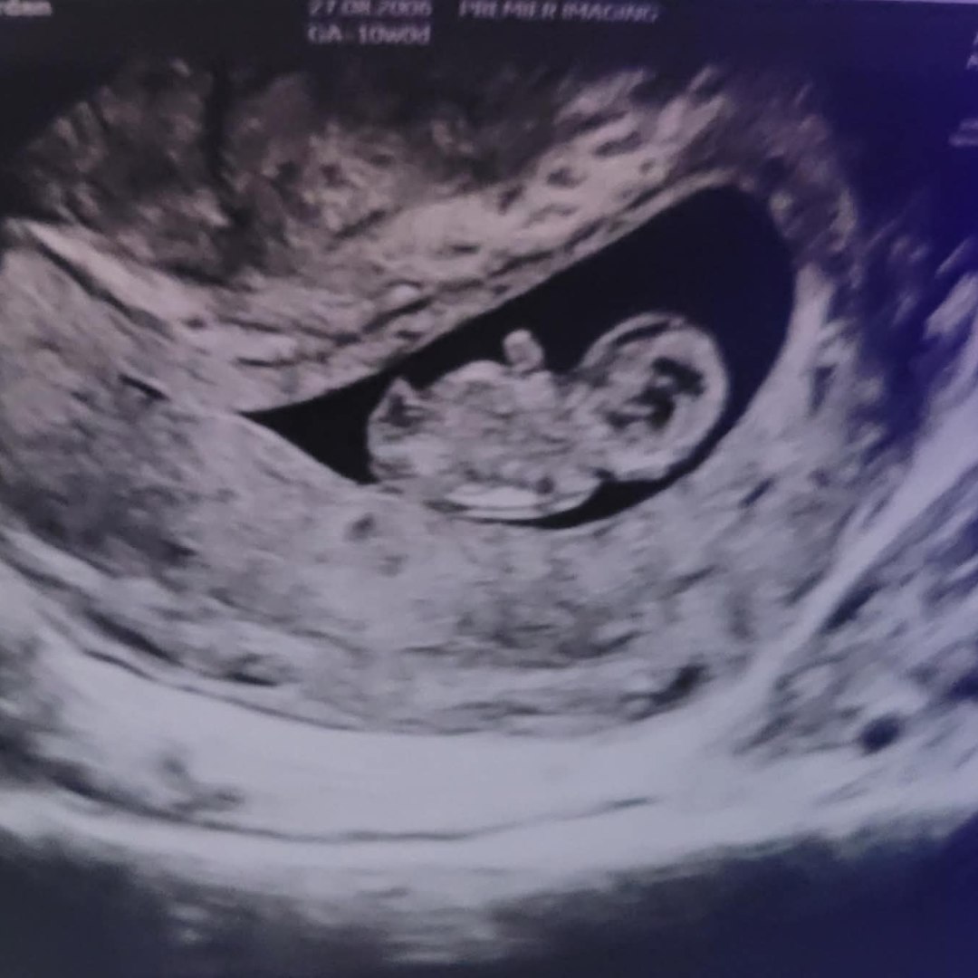 Photo shared by Brayden for their Babylist baby registry.
