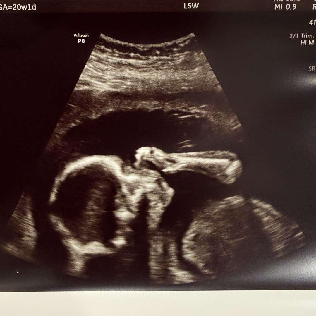 Photo shared by Kaya for their Babylist baby registry.