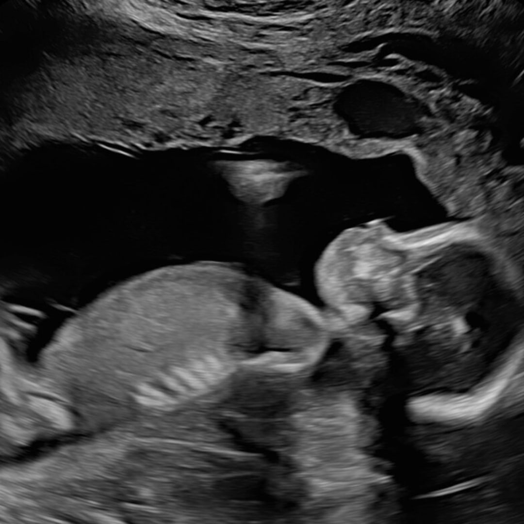 Photo shared by Morgan for their Babylist baby registry.