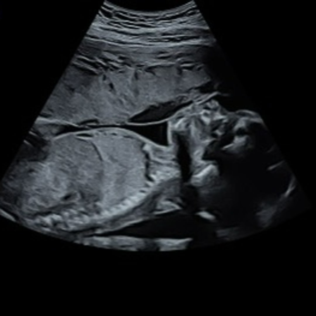 Photo shared by Corinne for their Babylist baby registry.
