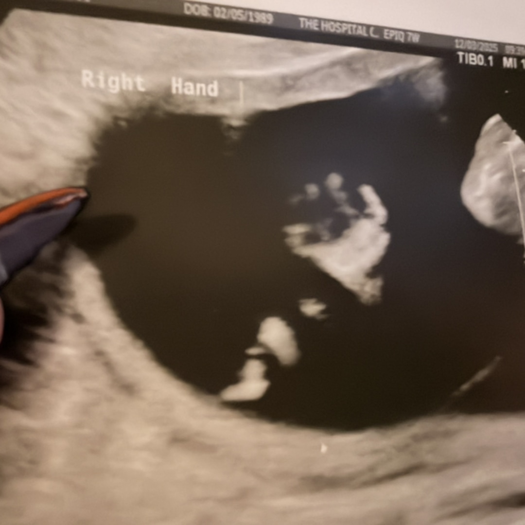 Photo shared by Rebecca for their Babylist baby registry.