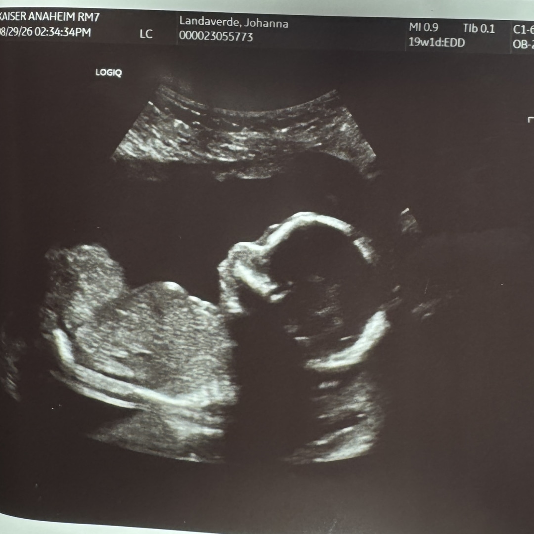 Photo shared by Johanna for their Babylist baby registry.