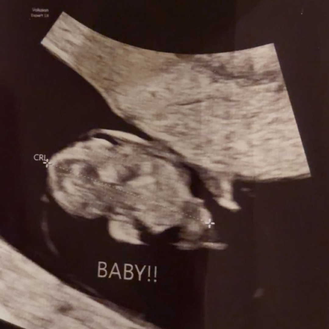 Photo shared by Morgan for their Babylist baby registry.