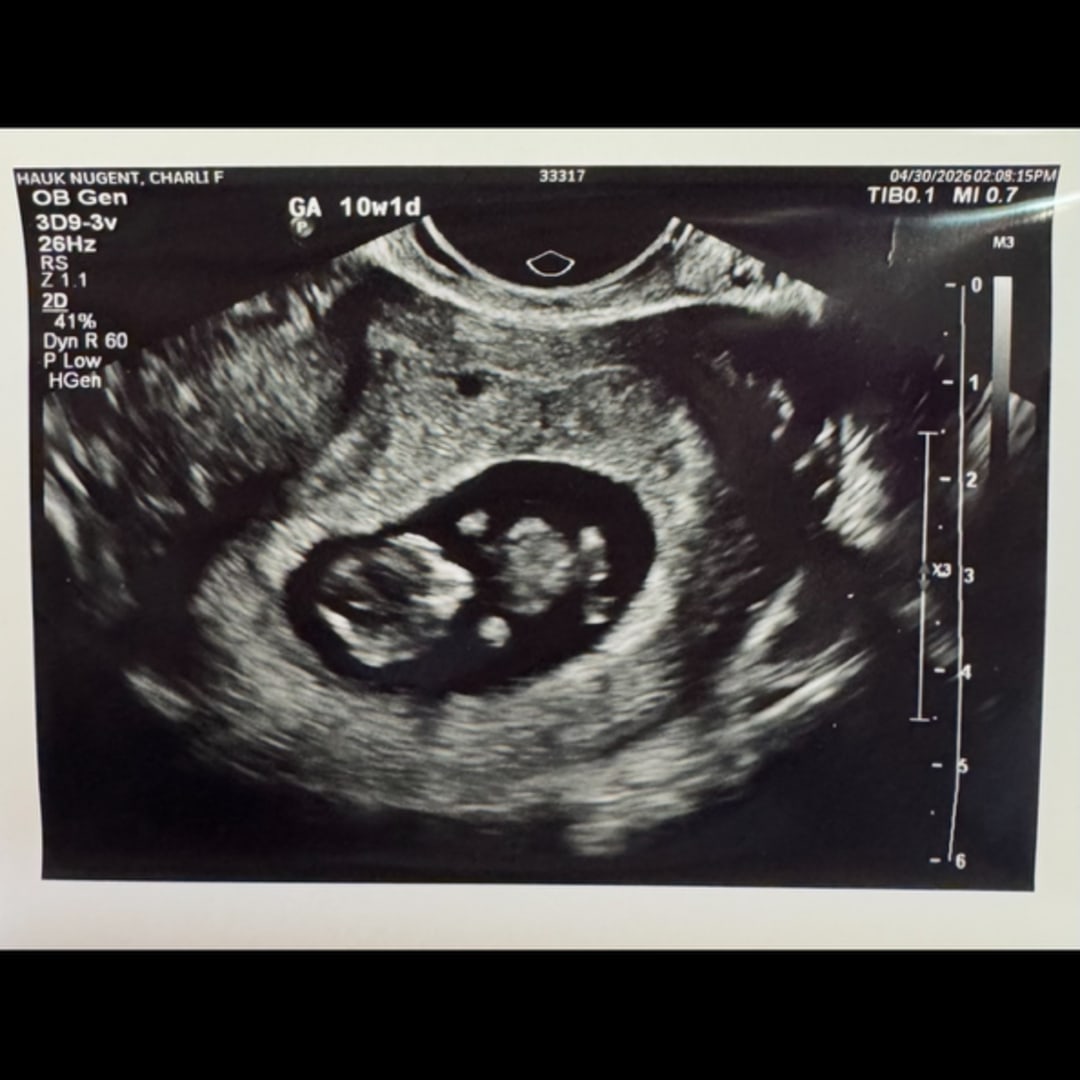 Photo shared by Charli Fay for their Babylist baby registry.