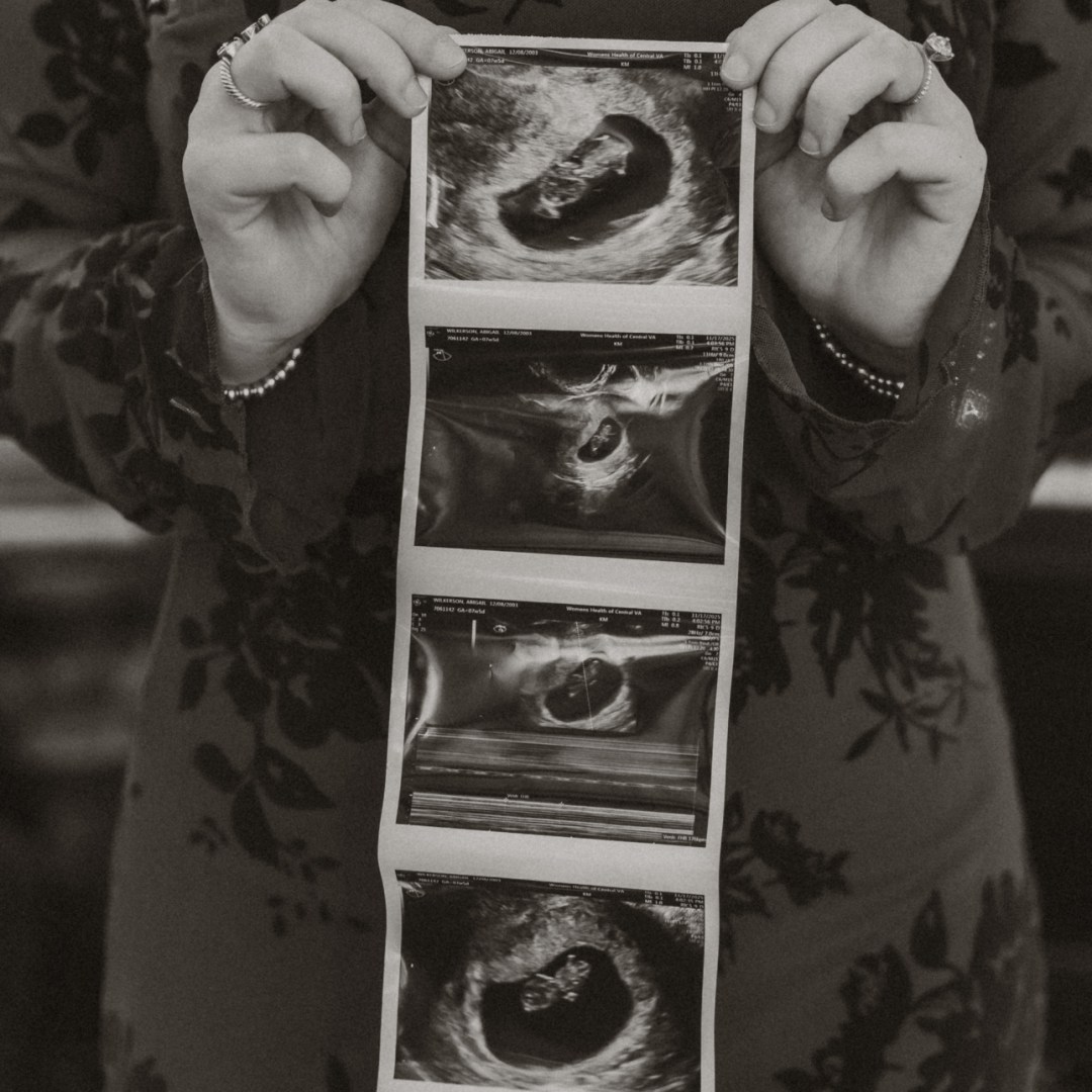 Photo shared by Abby for their Babylist baby registry.