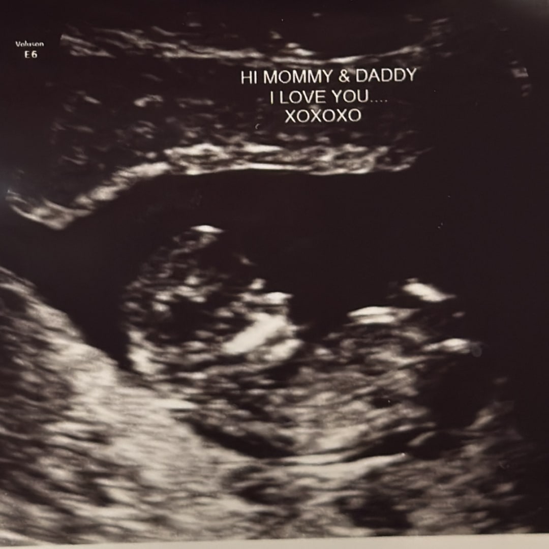 Photo shared by Kieran for their Babylist baby registry.