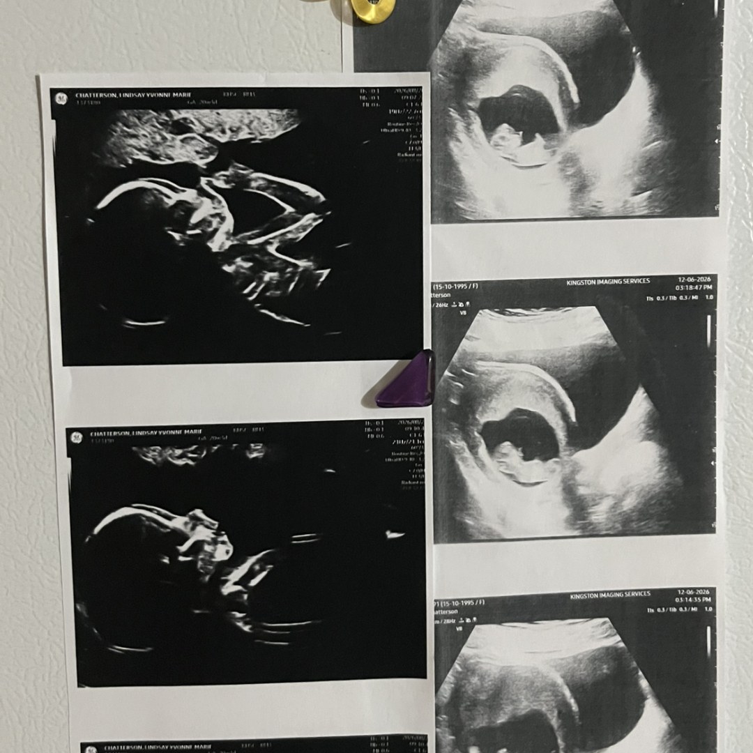 Photo shared by Lindsay for their Babylist baby registry.