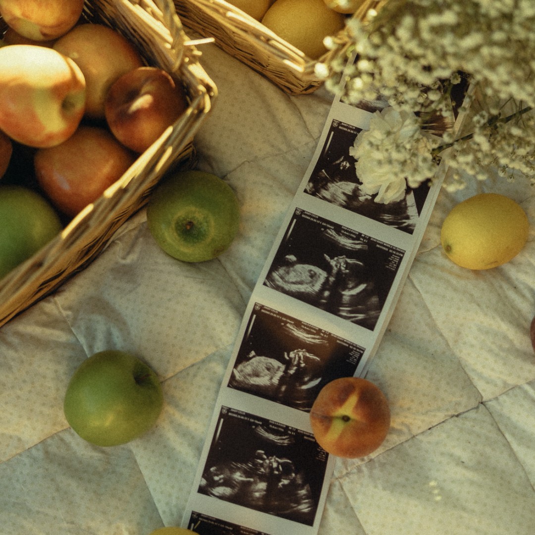 Photo shared by Cassandra for their Babylist baby registry.