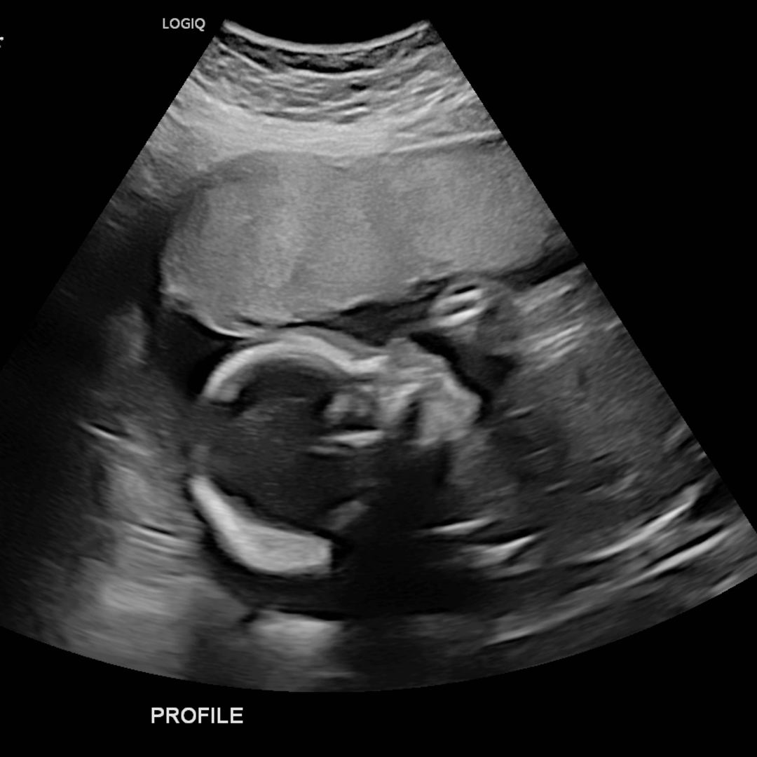 Photo shared by Adair for their Babylist baby registry.
