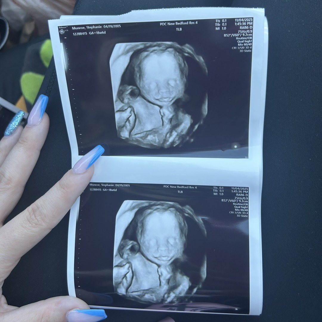 Photo shared by Stephanie for their Babylist baby registry.