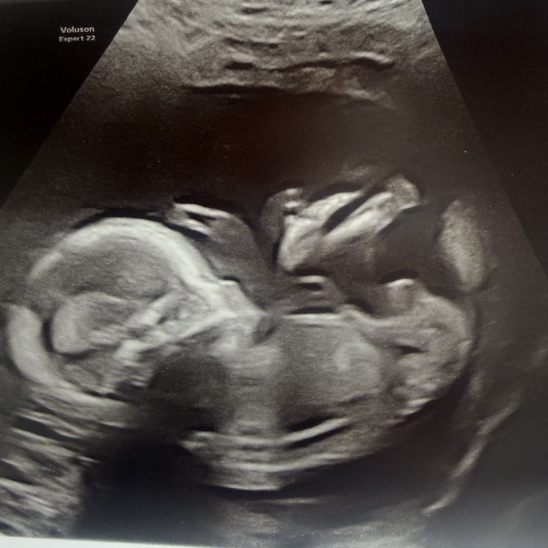 Photo shared by Ewelina for their Babylist baby registry.