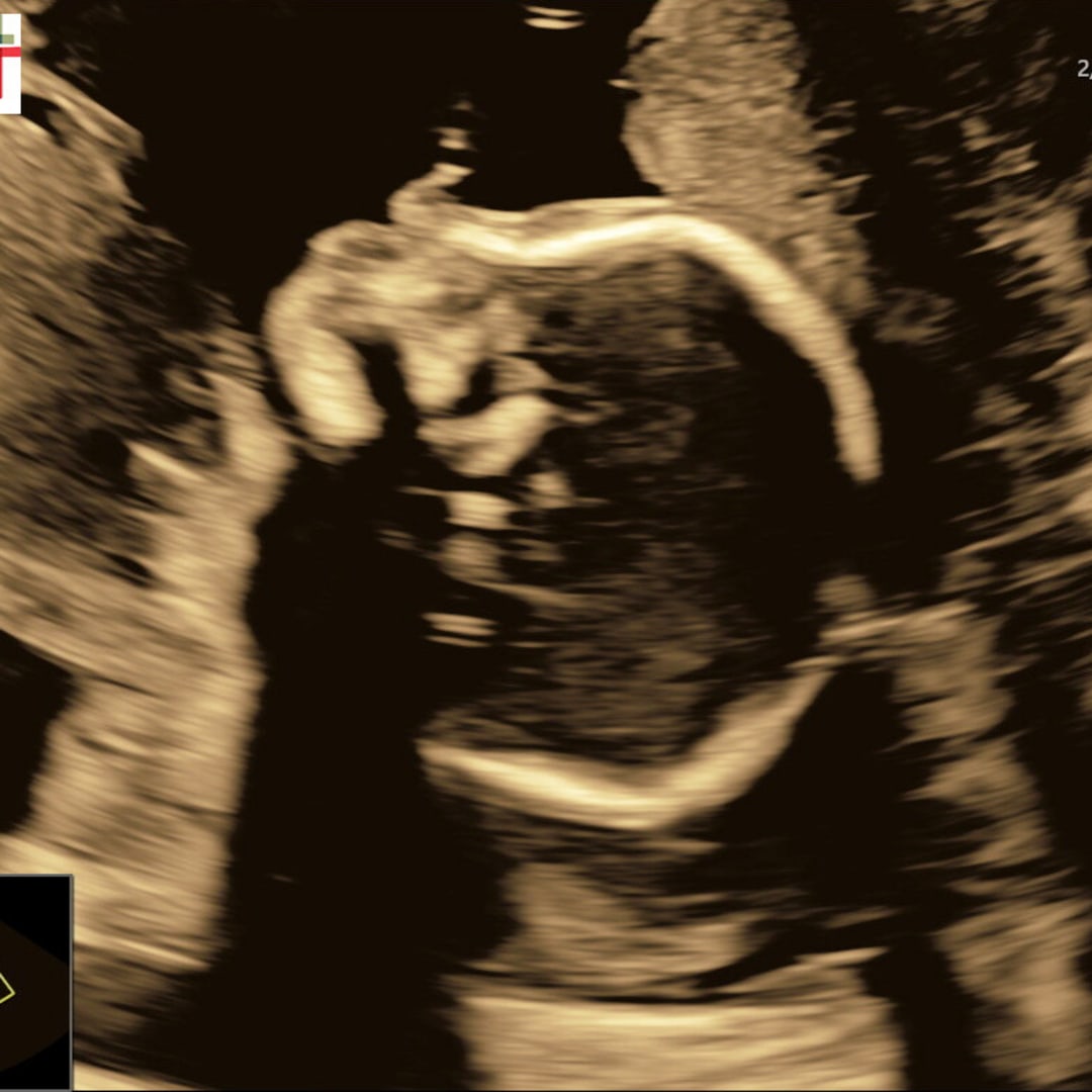Photo shared by Ashley for their Babylist baby registry.