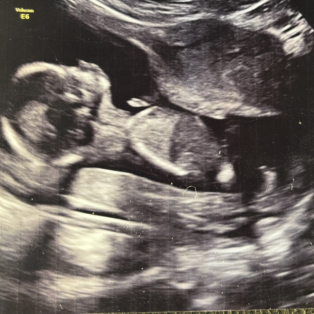 Photo shared by Joselyn for their Babylist baby registry.