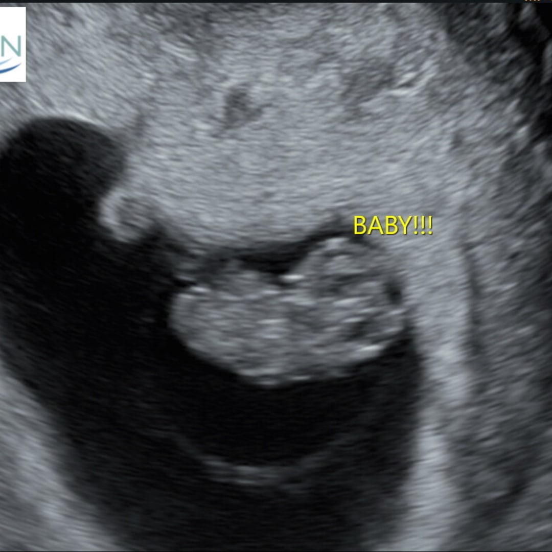 Photo shared by Trinity for their Babylist baby registry.