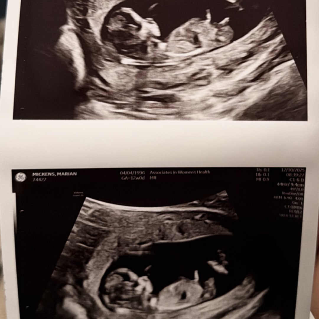 Photo shared by MaryRose for their Babylist baby registry.