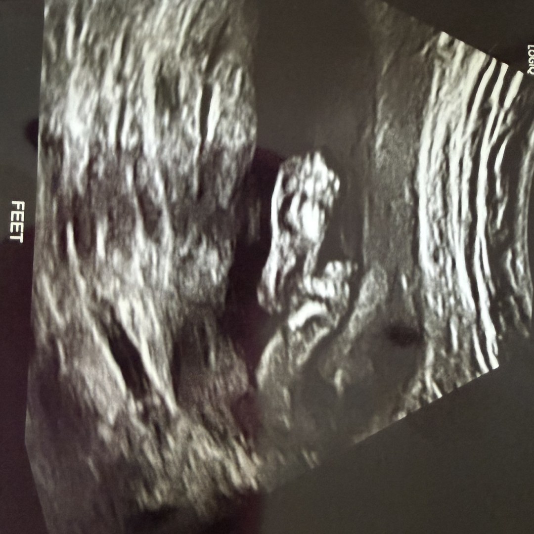 Photo shared by Ashley for their Babylist baby registry.