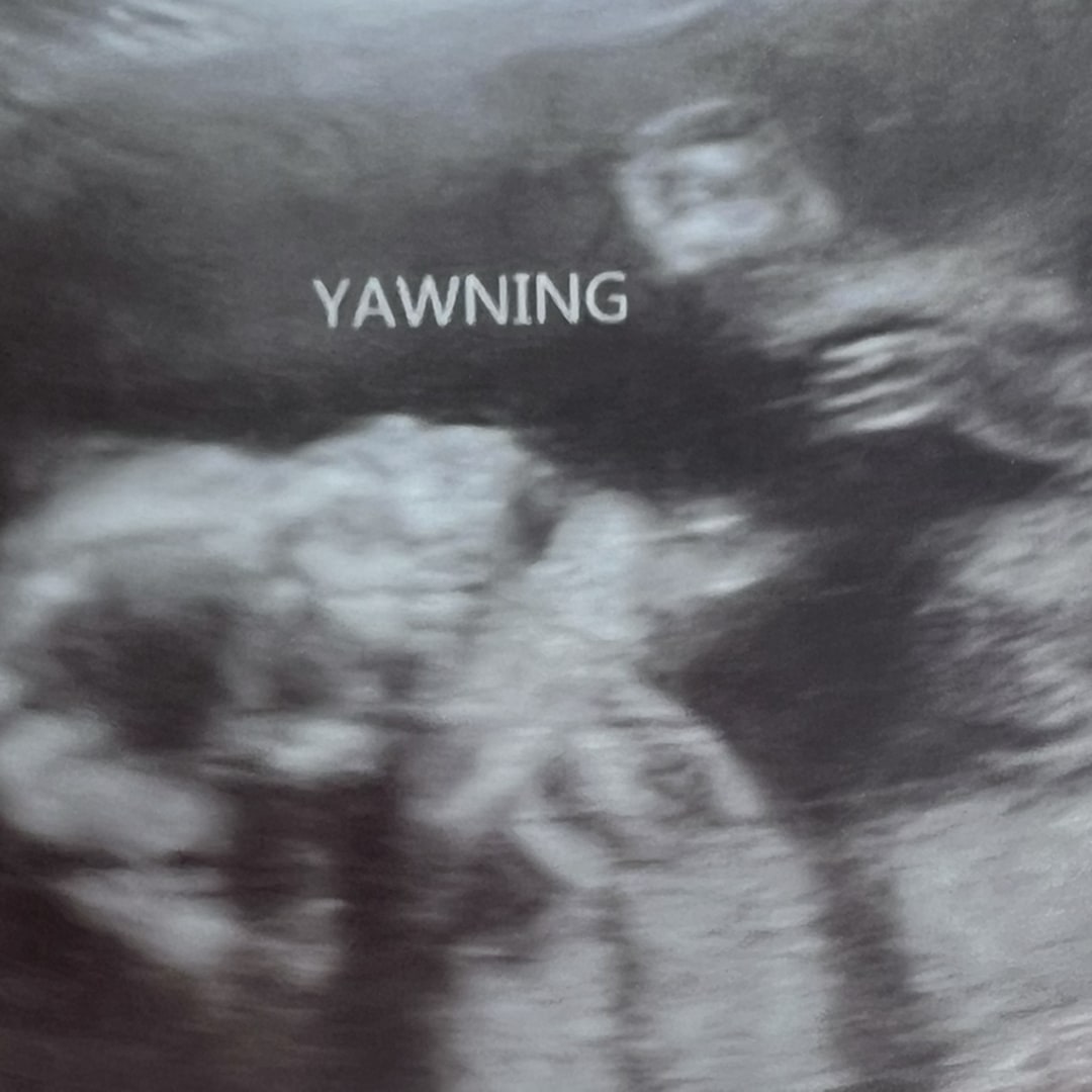 Photo shared by Ariz for their Babylist baby registry.