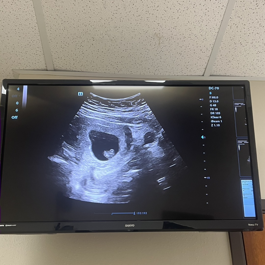 Photo shared by Yulia for their Babylist baby registry.