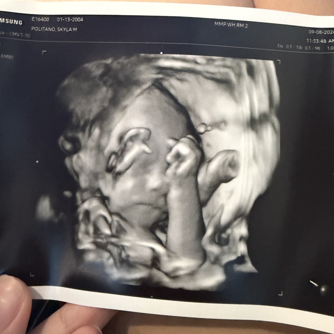 Photo shared by Skyla for their Babylist baby registry.