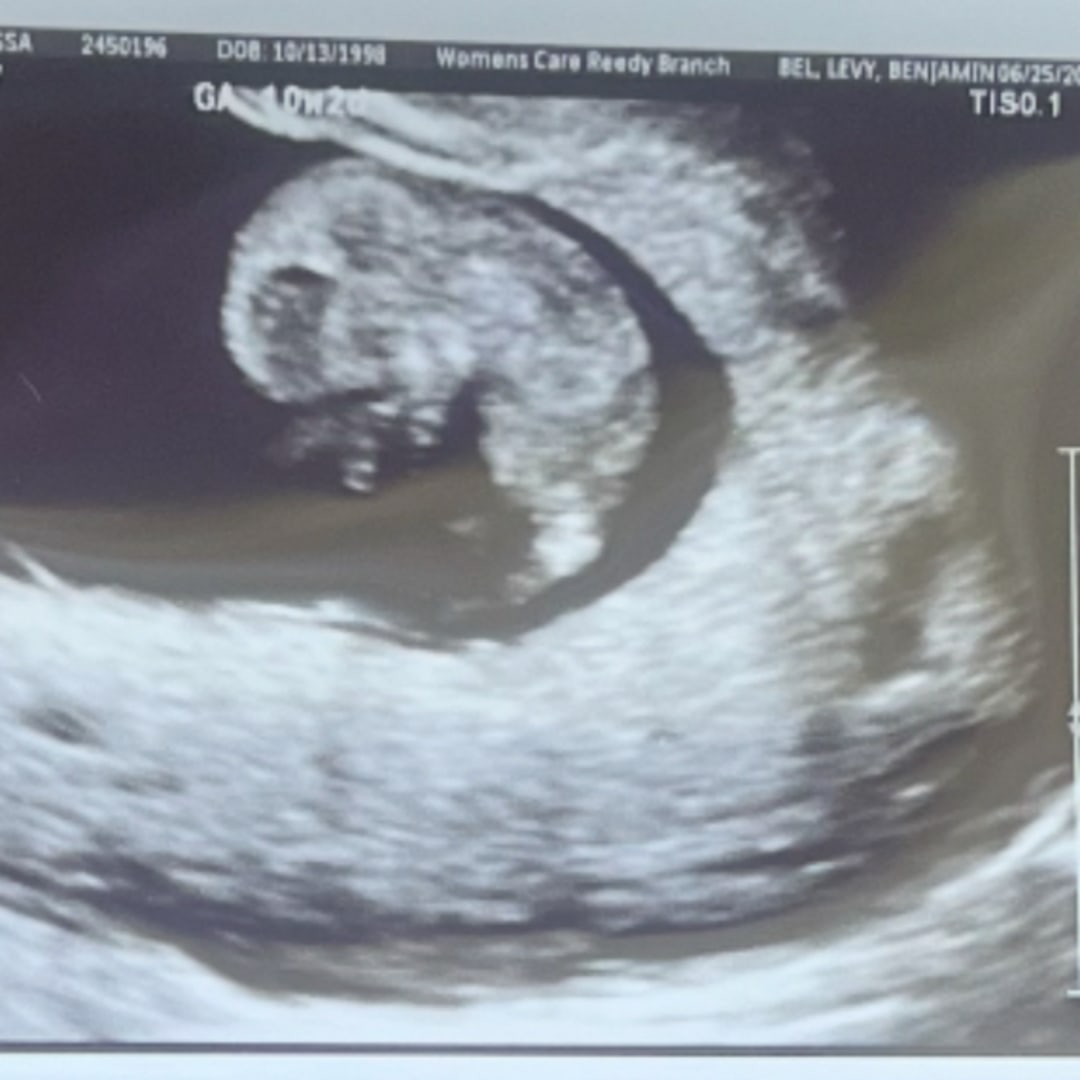 Photo shared by Alyssa for their Babylist baby registry.