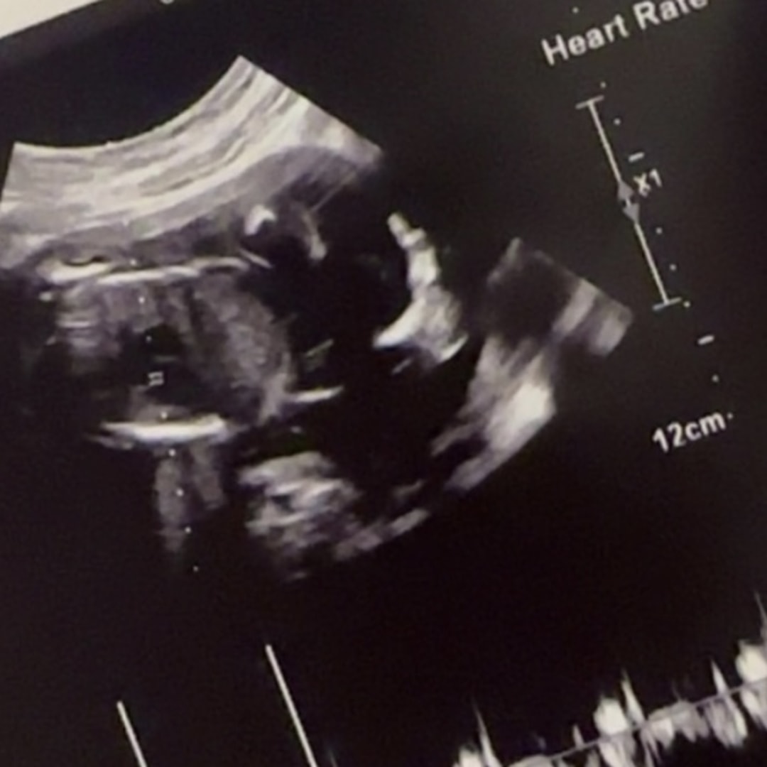 Photo shared by Rosanna for their Babylist baby registry.