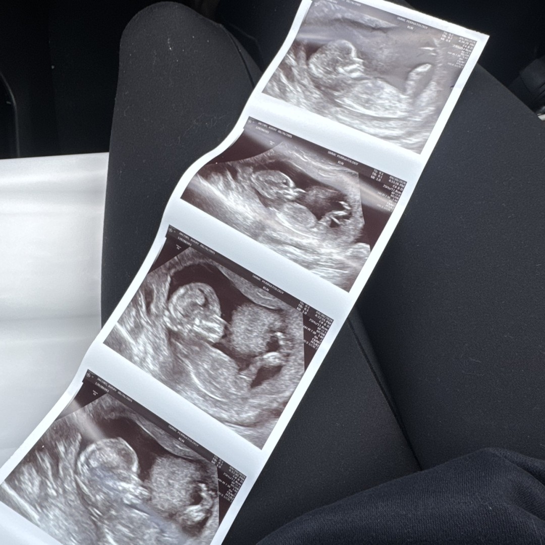 Photo shared by Avery for their Babylist baby registry.
