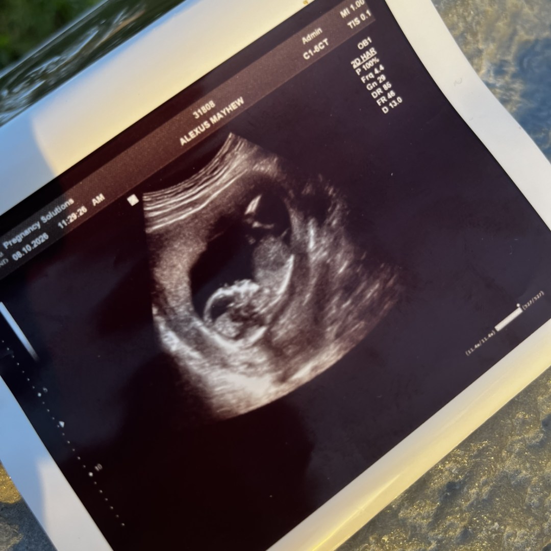 Photo shared by Alexus for their Babylist baby registry.