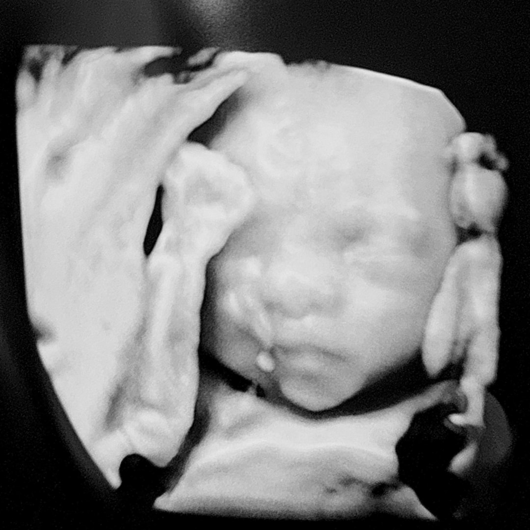 Photo shared by Deana for their Babylist baby registry.