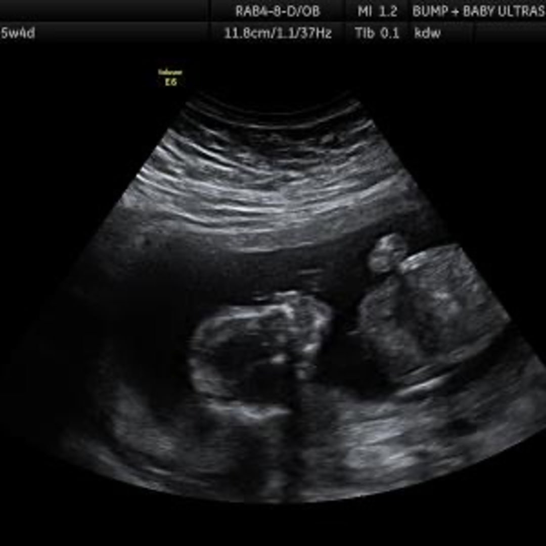 Photo shared by Erin for their Babylist baby registry.