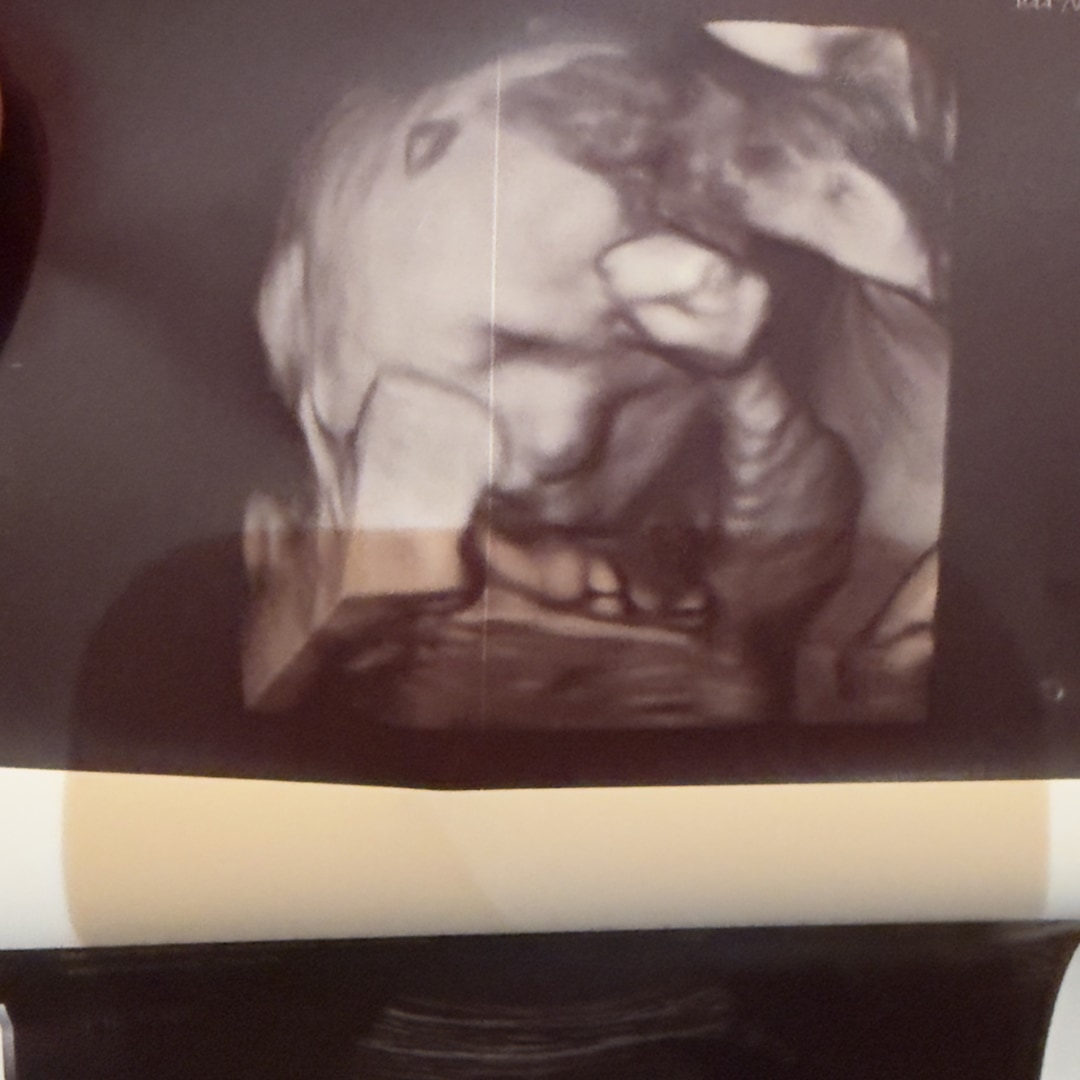 Photo shared by Rodaina for their Babylist baby registry.