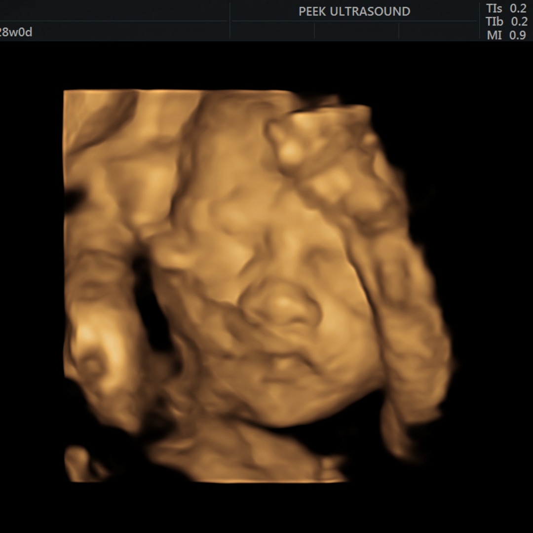 Photo shared by Yamileth for their Babylist baby registry.