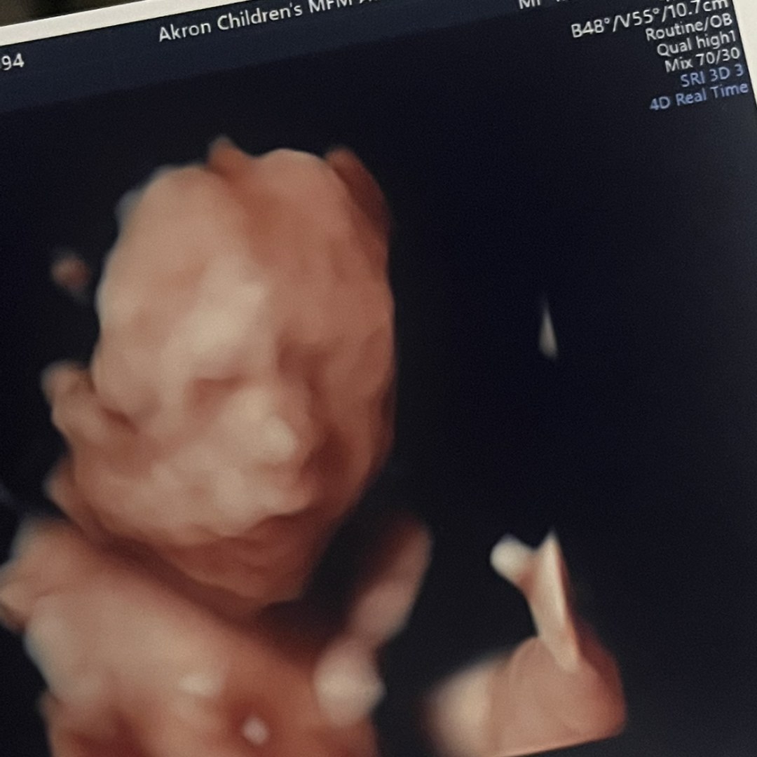 Photo shared by Chelsey for their Babylist baby registry.