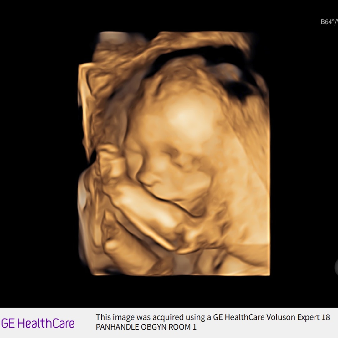 Photo shared by Jaelynn for their Babylist baby registry.