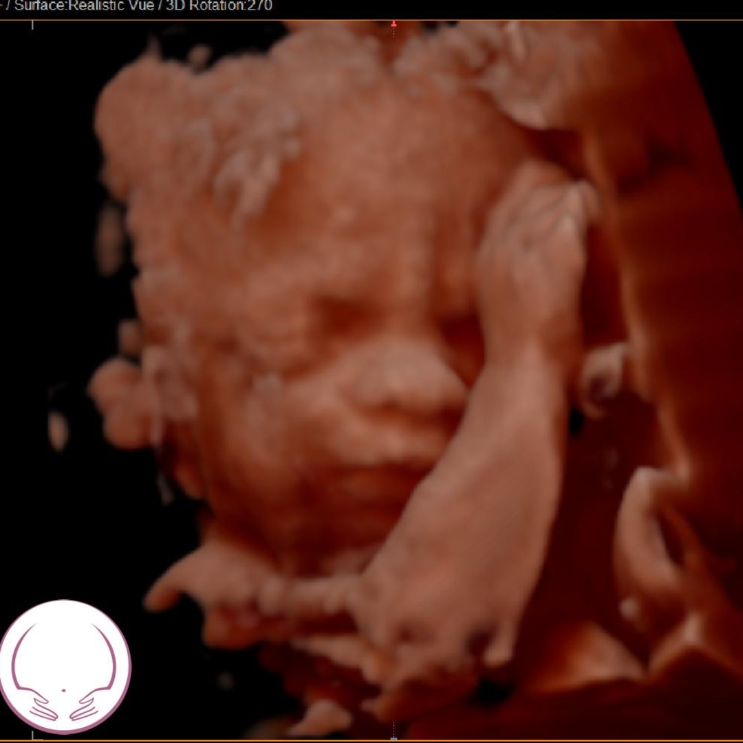 Photo shared by Caitlin for their Babylist baby registry.