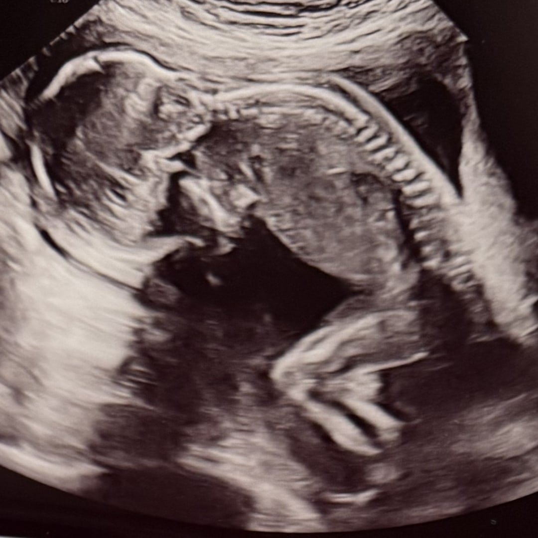 Photo shared by Elevia for their Babylist baby registry.