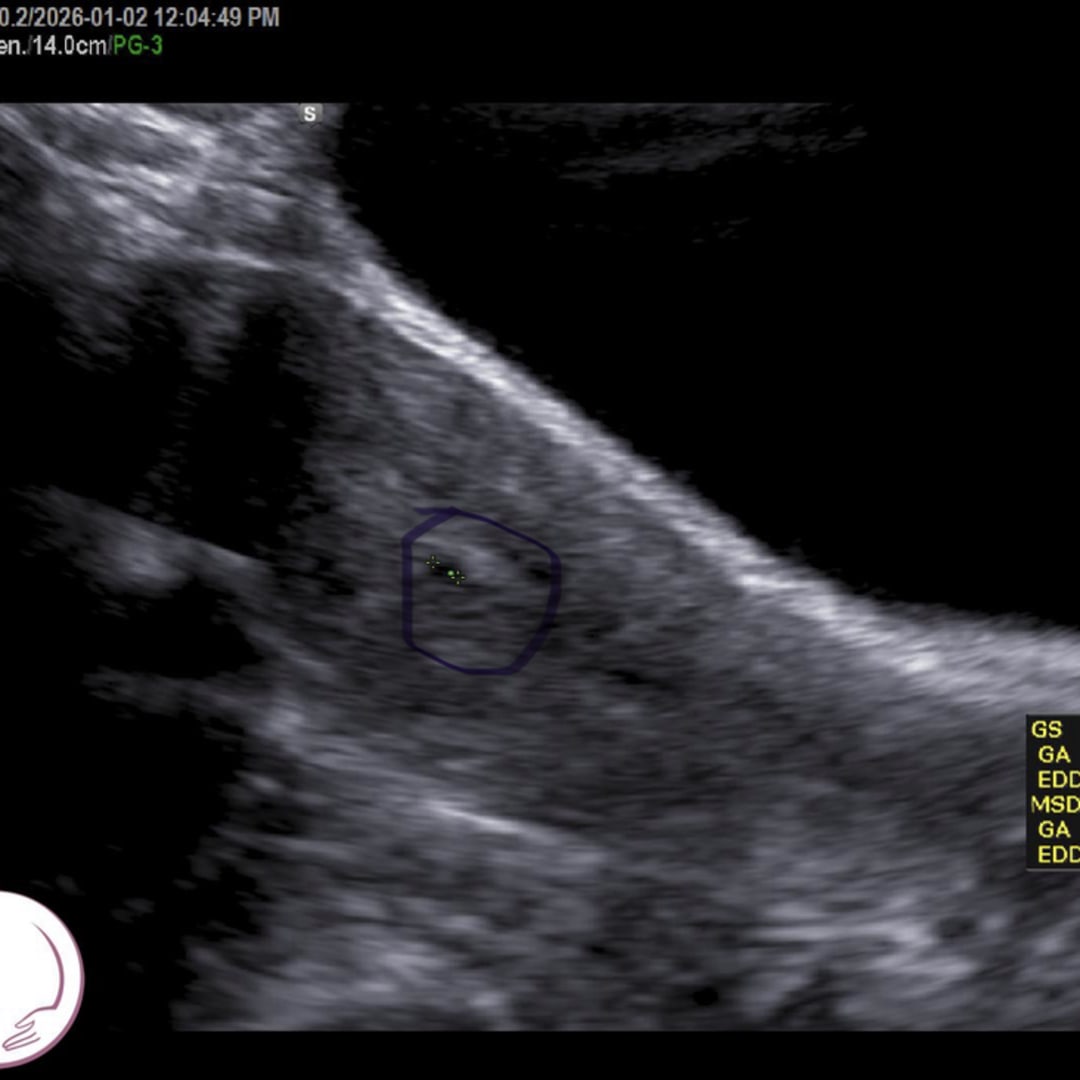 Photo shared by Amanda for their Babylist baby registry.