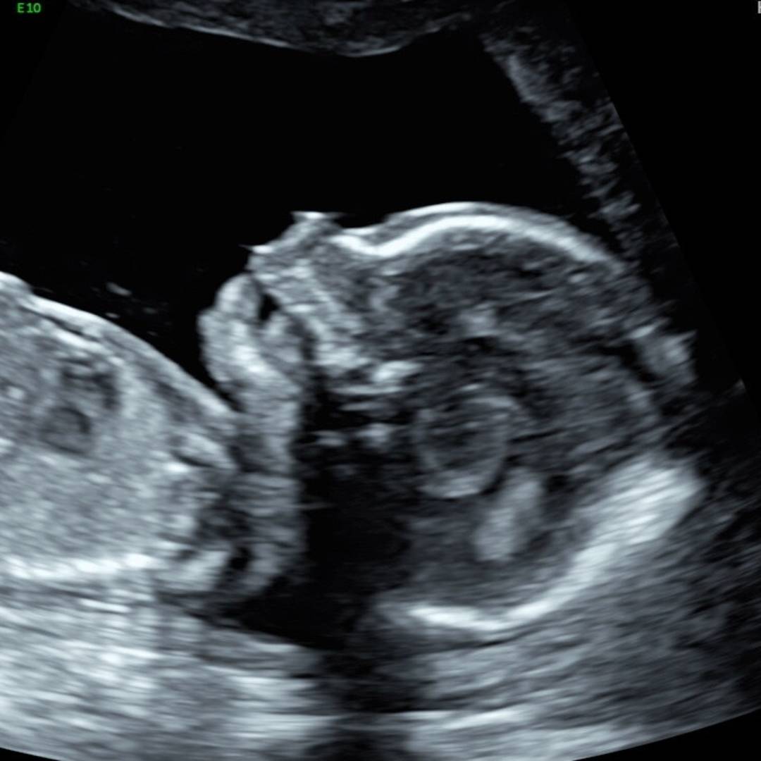 Photo shared by Kadin for their Babylist baby registry.