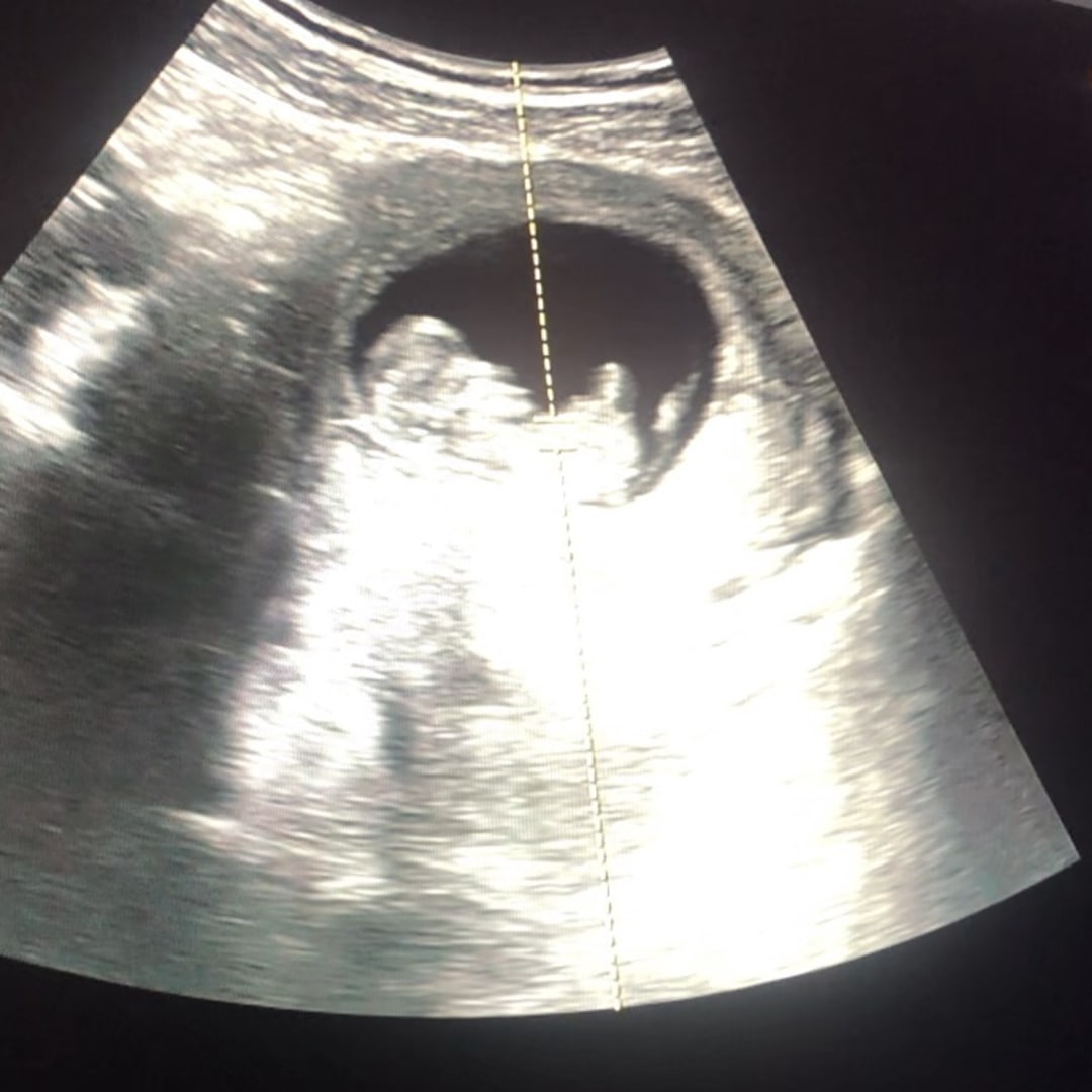 Photo shared by Joey for their Babylist baby registry.