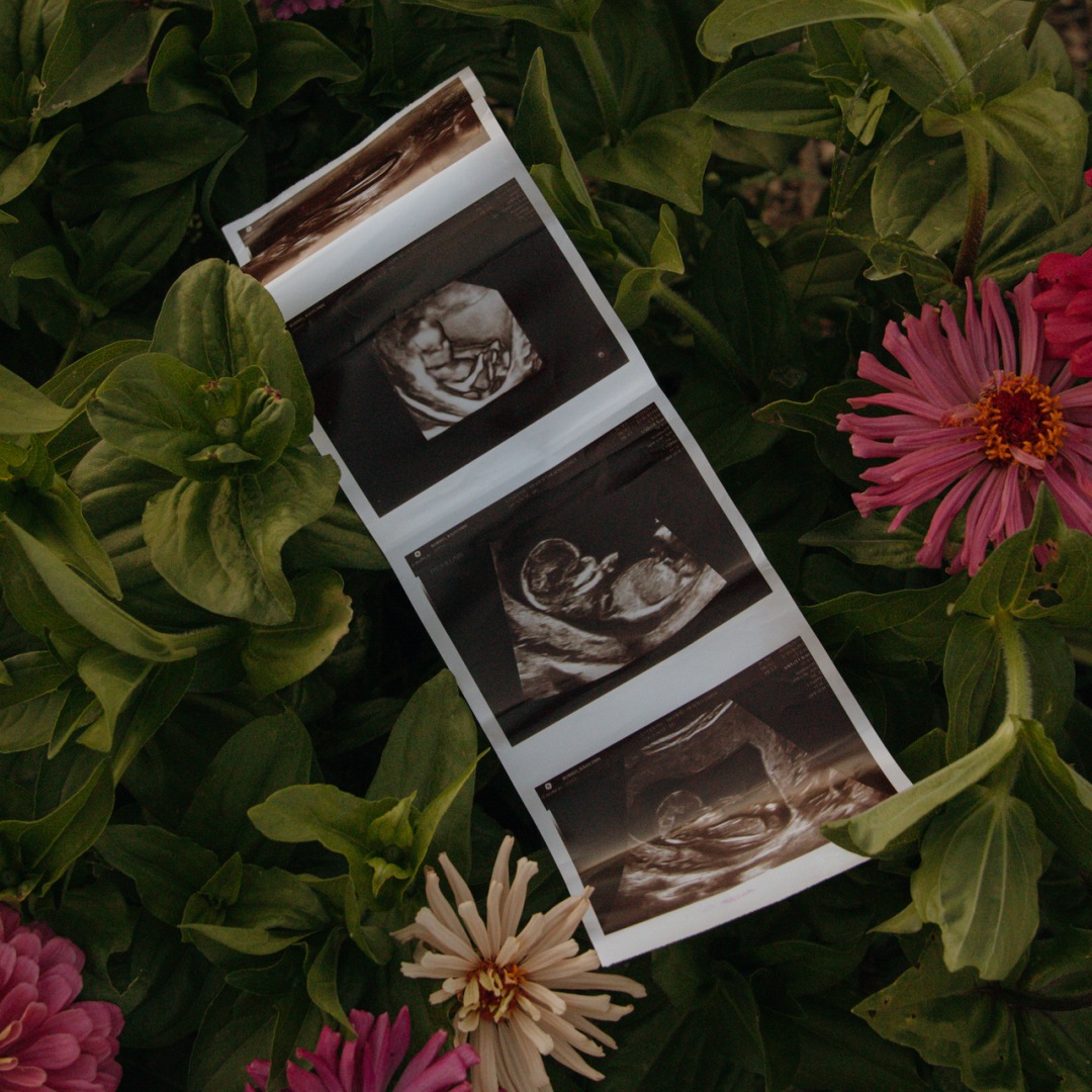 Photo shared by Kaitlynn for their Babylist baby registry.